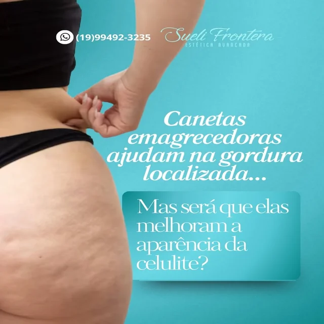 Resultado de tratamento estético corporal